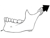 顎の骨格